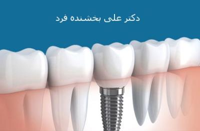 دکتر علی بخشنده فرد متخصص ایمپلنت در شرق تهران