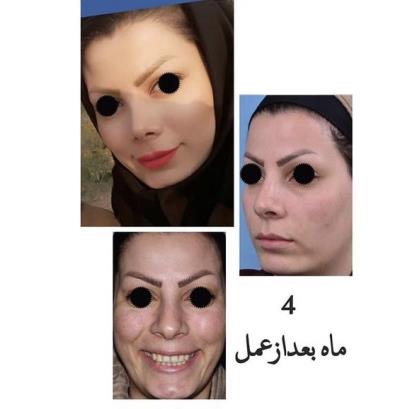 جراح فک و صورت در تهران