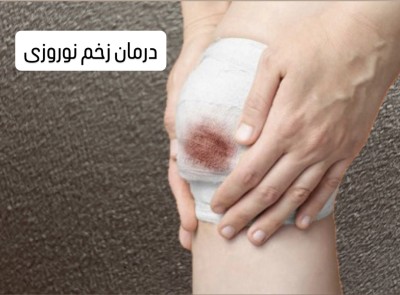 متخصص درمان زخم در شهر قزوین